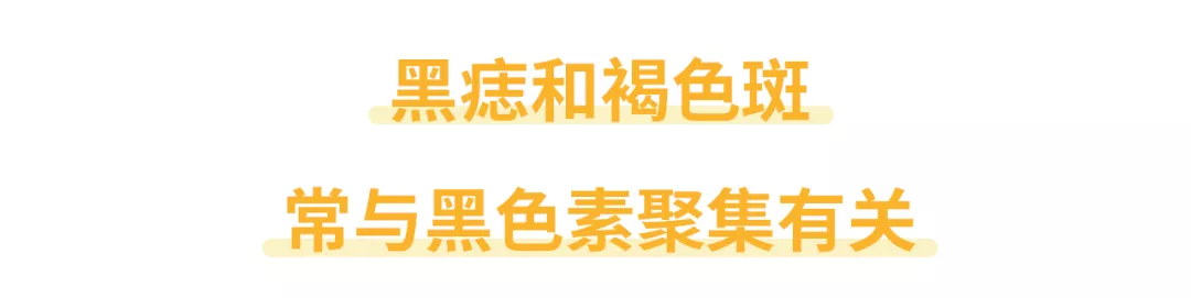 长成这样的痣和色斑，是黑色素瘤的预备军？