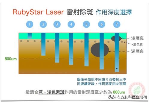 先分清脸上的斑，再考虑应该做激光还是喝中药