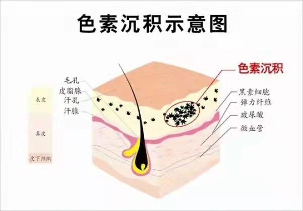 泗阳小姐姐看过来，你们要的美白淡斑方法找到了