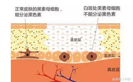 究竟斑该怎么祛才有效？给你套祛斑方案