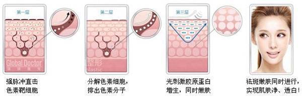 堪比磨皮的祛斑方法一定要知道