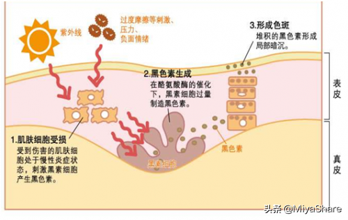 如何高效美白、淡斑？3个实用方法：最有效的竟不是用美白精华