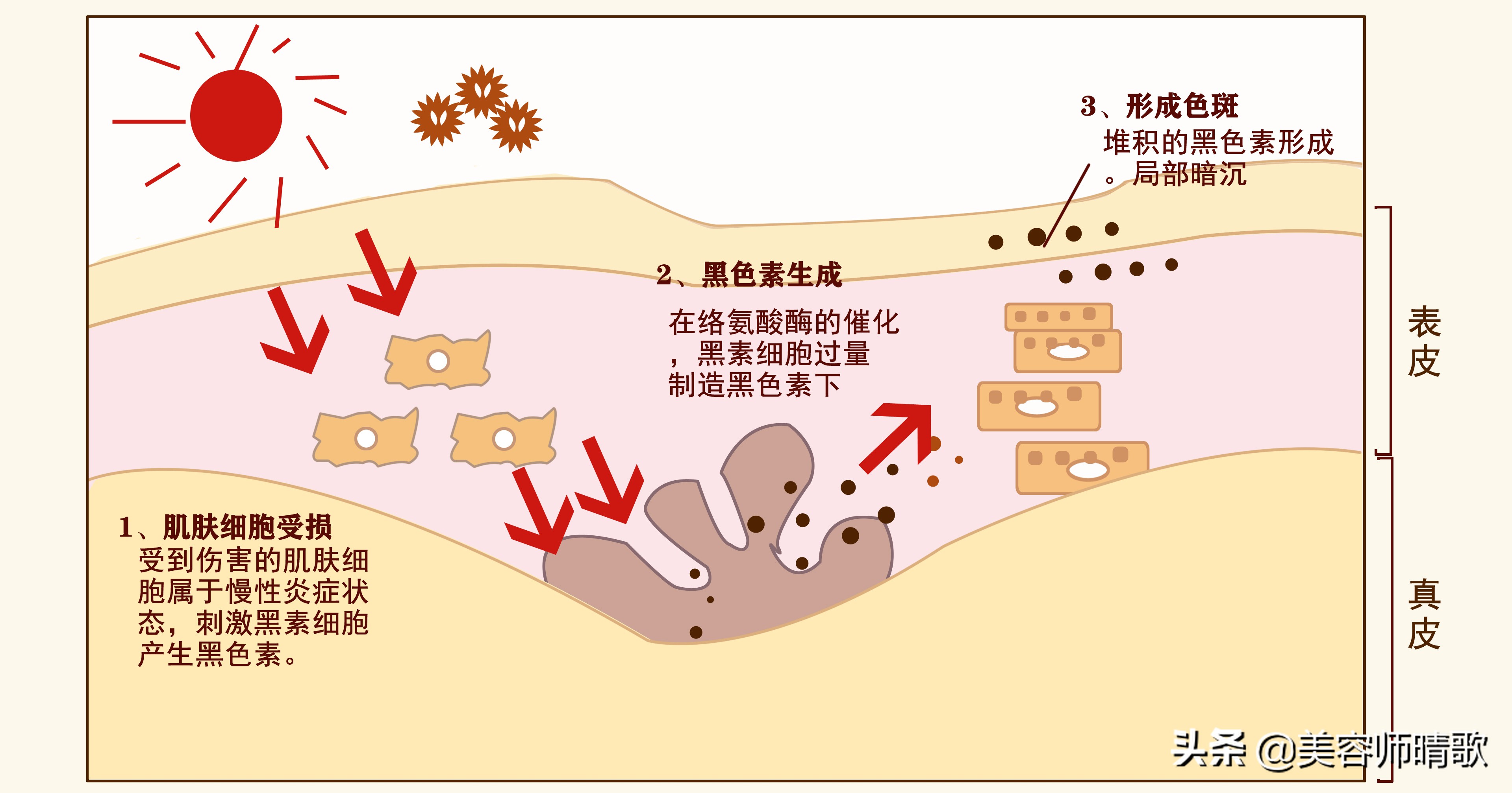 战胜色斑攻略 | 超实用的，对付色斑的方法来了