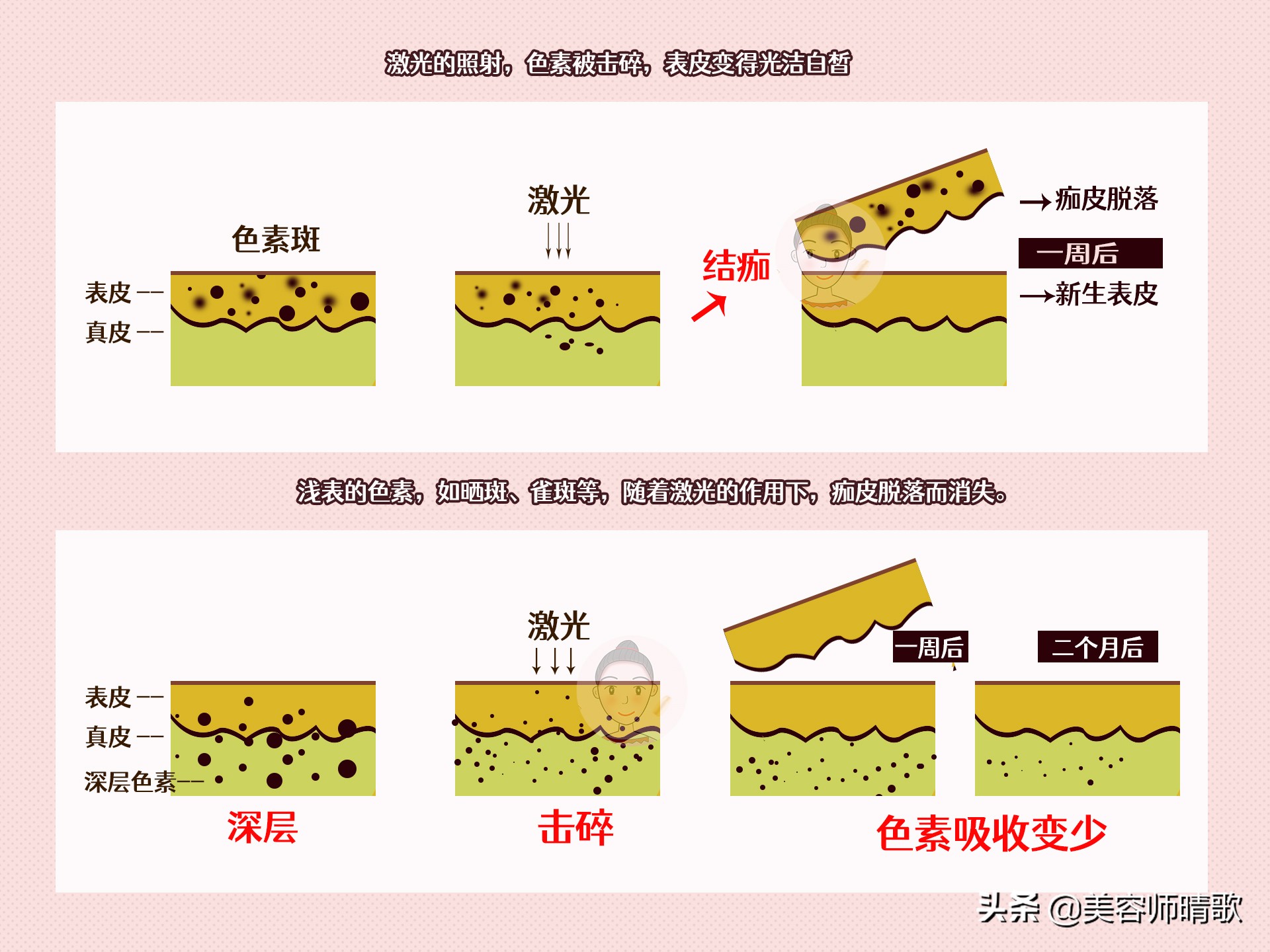 战胜色斑攻略 | 超实用的，对付色斑的方法来了