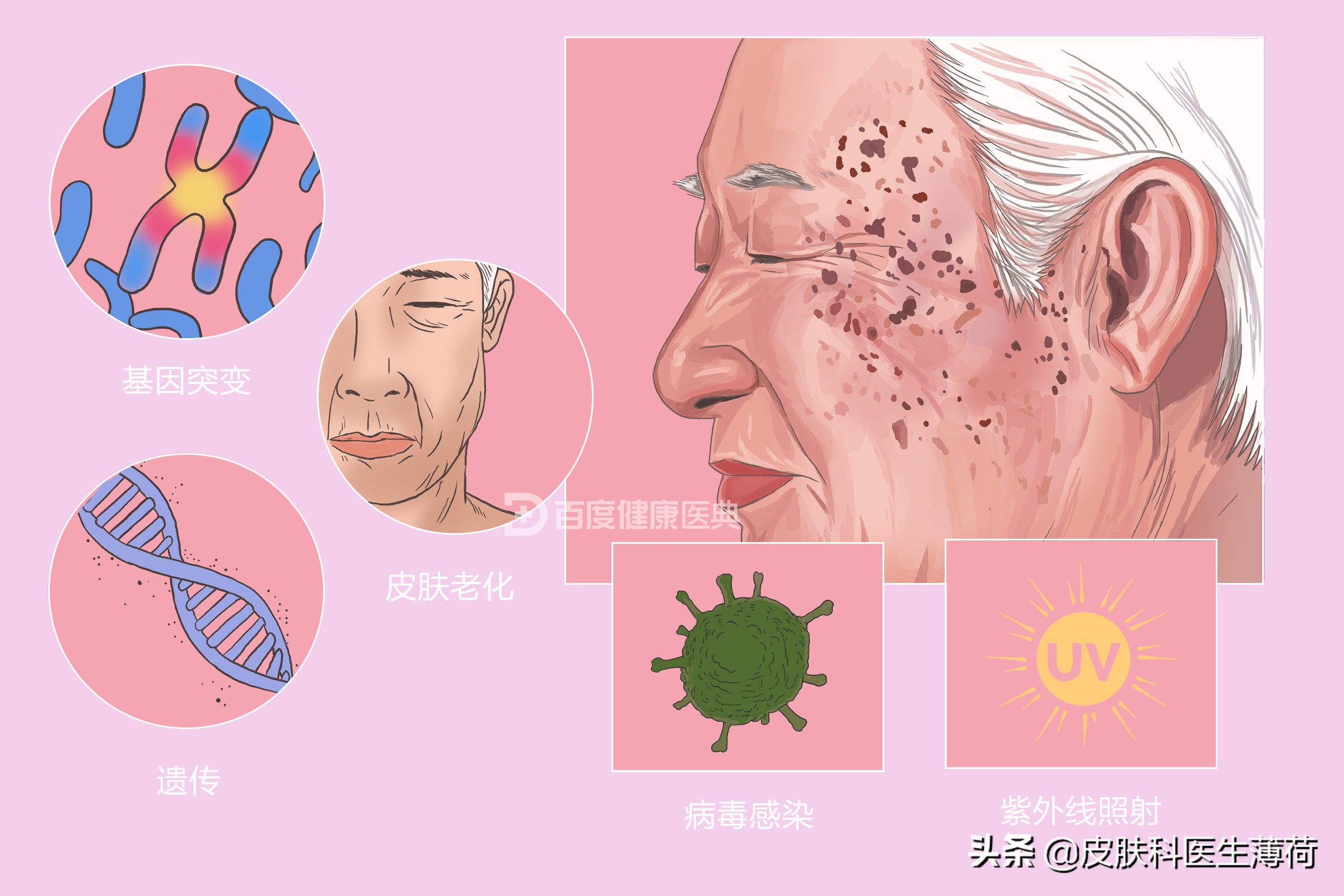 看图识斑｜一文教你辨识自己长的究竟是啥斑？