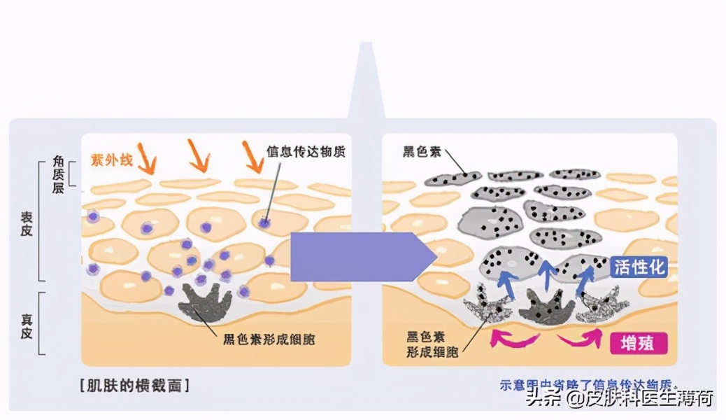 看图识斑｜一文教你辨识自己长的究竟是啥斑？