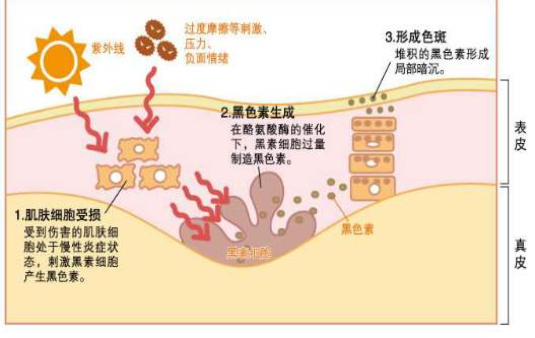 蜂蜜能淡化色斑吗？效果怎么样？