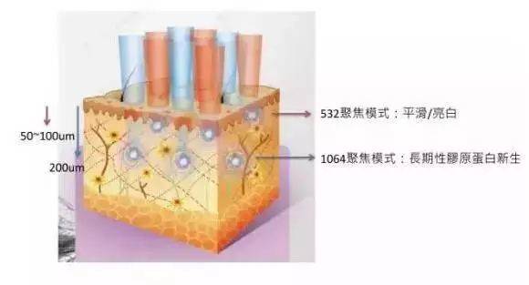 做了超皮秒，我的脸三天变成了这样