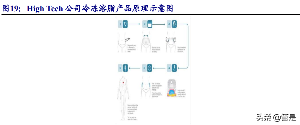 华东医药研究报告：医美产品矩阵逐渐丰富，工商业转型拐点将现