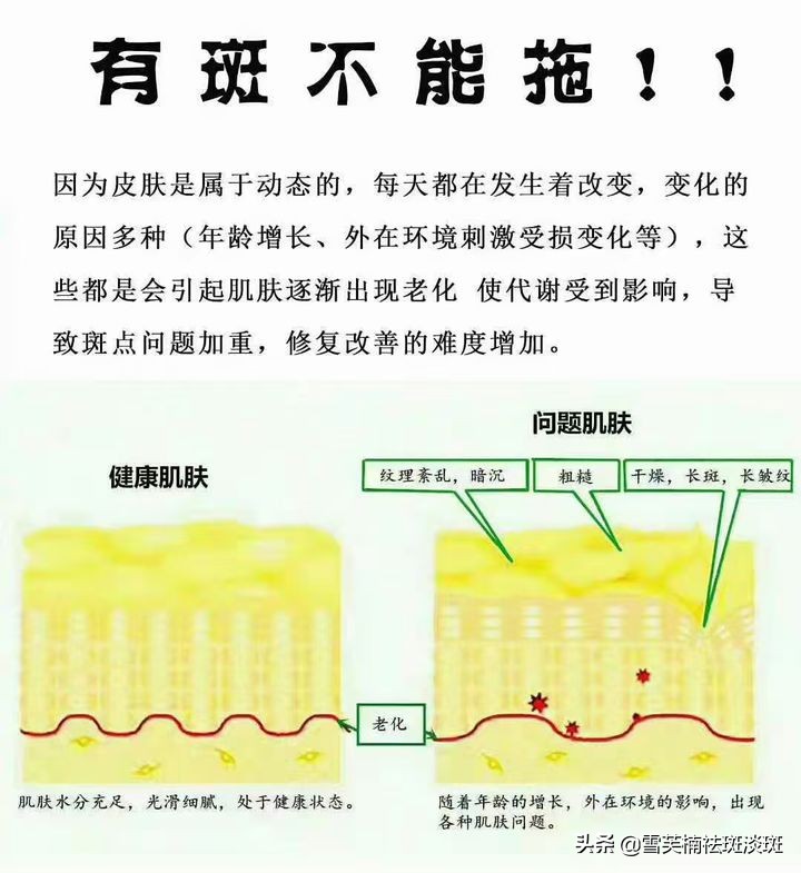 怎样祛斑好？简单有效的祛斑方法可以让斑点淡化