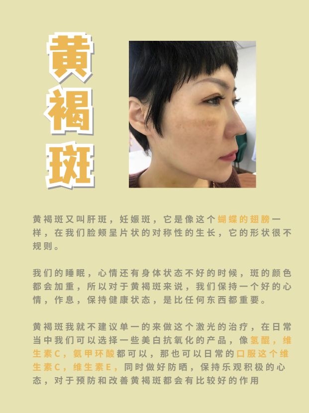 专业医生最全解析，淡斑祛斑全攻略