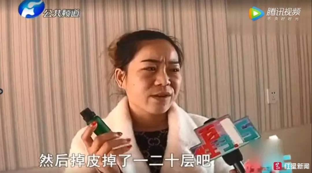 可怕！“华佗传人”授权的祛斑品竟让女子脸掉了几十层皮！