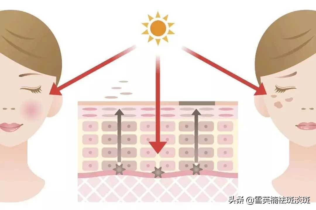 怎么祛斑最安全不反弹？坚持这个祛斑方法，快速祛斑不留痕