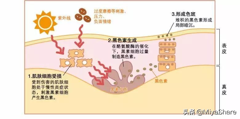 5款美白精华：玉兰油平价，城野医生实用，修丽CE+发光瓶白到发光