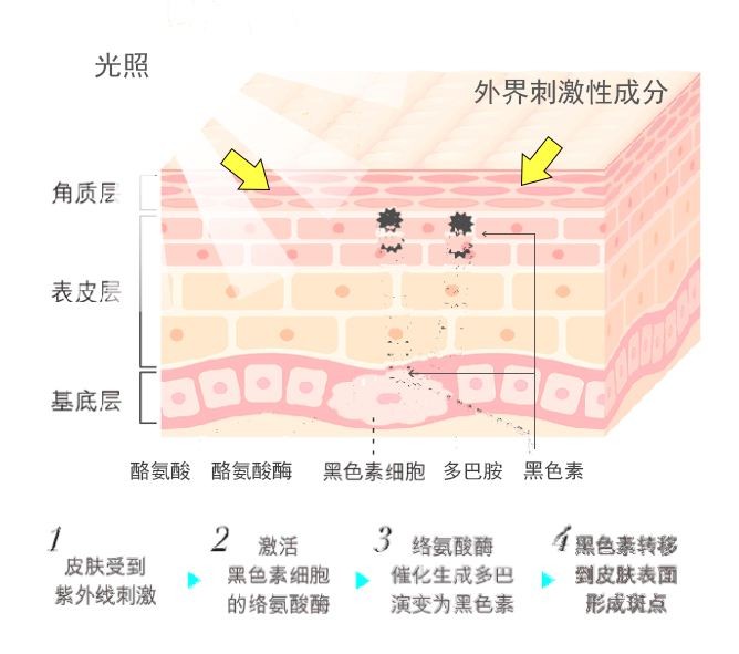 新一代生物技术美白去斑，引领时代潮流