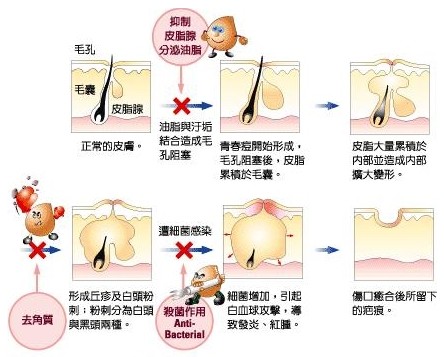 祛痘斑效果最好的产品，祛痘除痘印有强效新方 民间流行抗痘痘秘籍