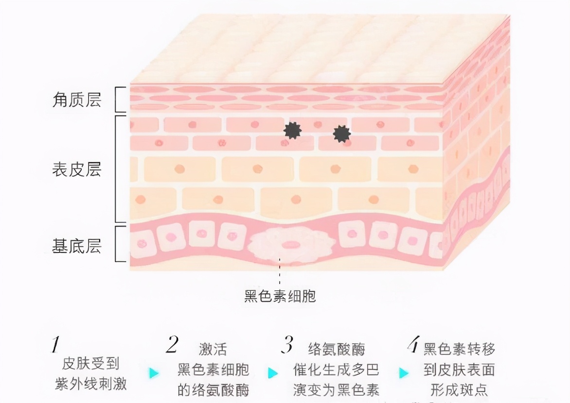 祛斑怎么使用，淡斑、祛斑该怎么做？看这篇！美肤名匠超全总结