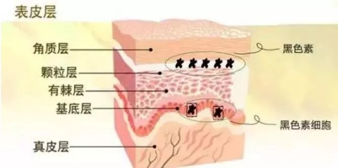 祛斑后为什么还会反黑？