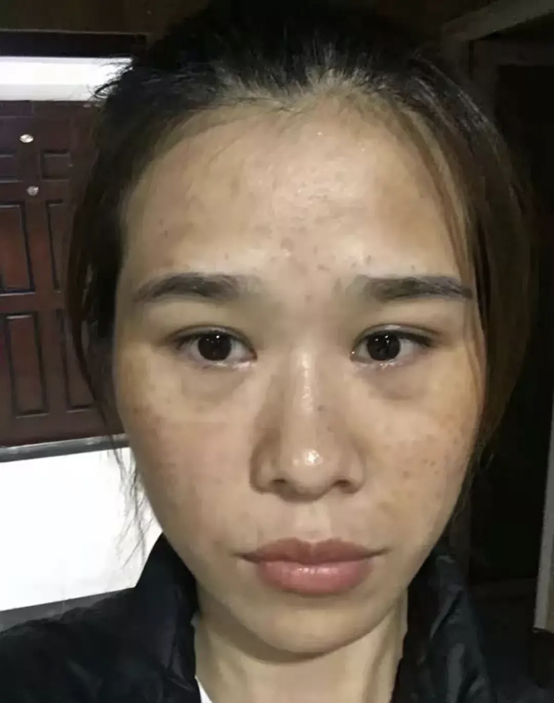 还为脸上的斑发愁吗？听听祛斑女孩5年经验，拒绝花冤枉钱