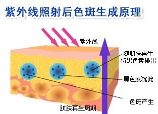 教你几个如何淡斑的方法，帮你打造祛斑美人