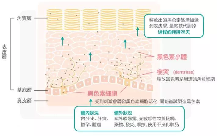 激光治疗黄褐斑靠谱吗？