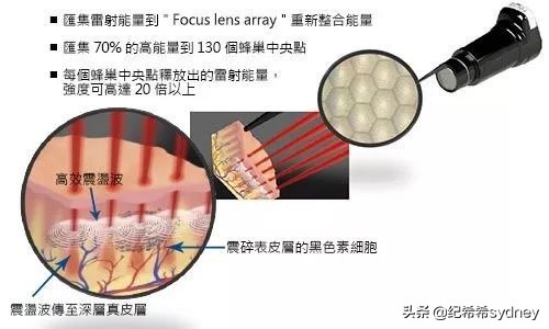 皮秒实测报告 | 对抗痘印斑点，粗大毛孔肌的杀手来了