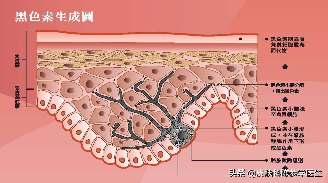 雀斑是怎么回事？该怎么治疗？治好后会不会复发？