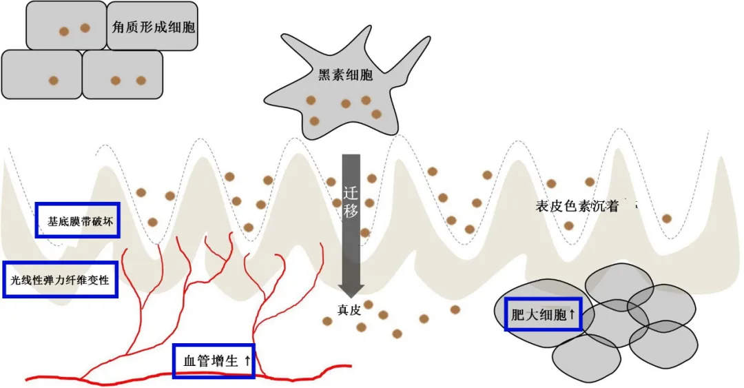 轻度黄褐斑图片，怪不得黄褐斑这么难治，原来不仅是色斑问题，还有光老化