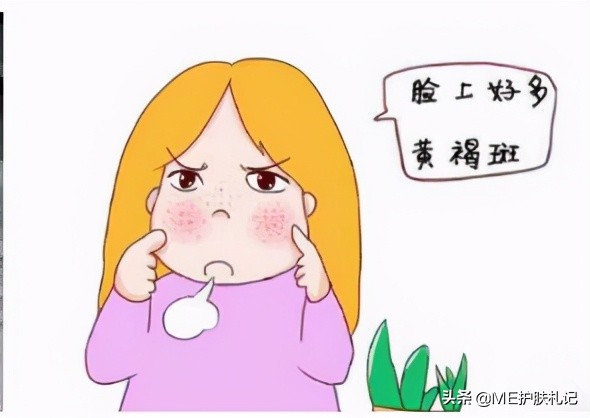 ME胶原蛋白科普：13种不同的色斑，你能分得清吗？