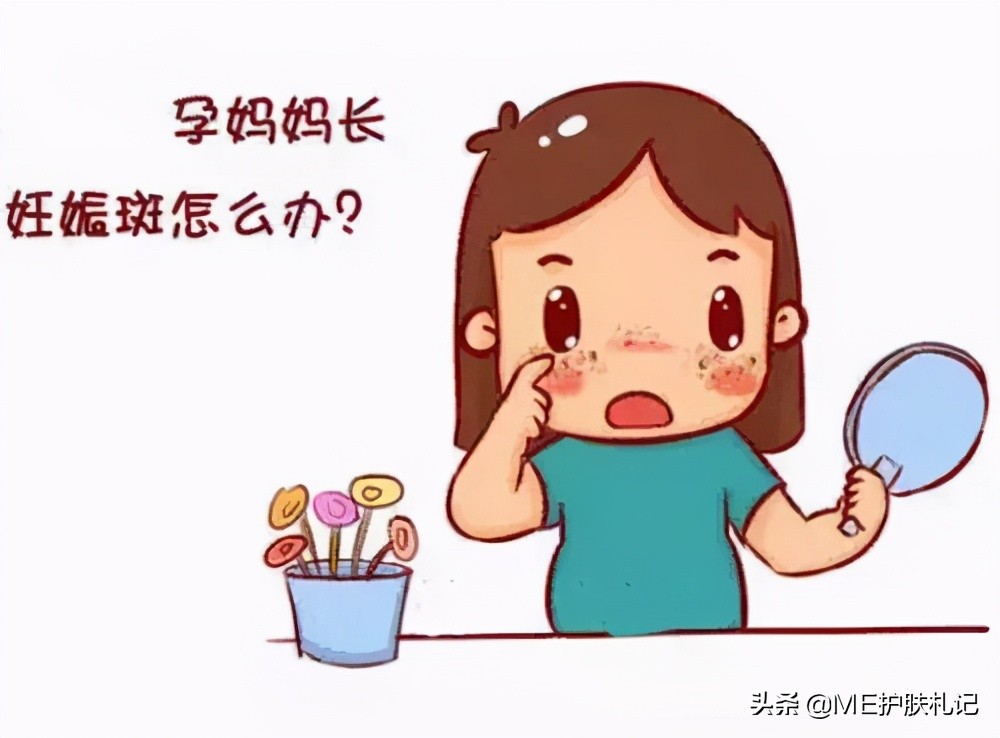 ME胶原蛋白科普：13种不同的色斑，你能分得清吗？