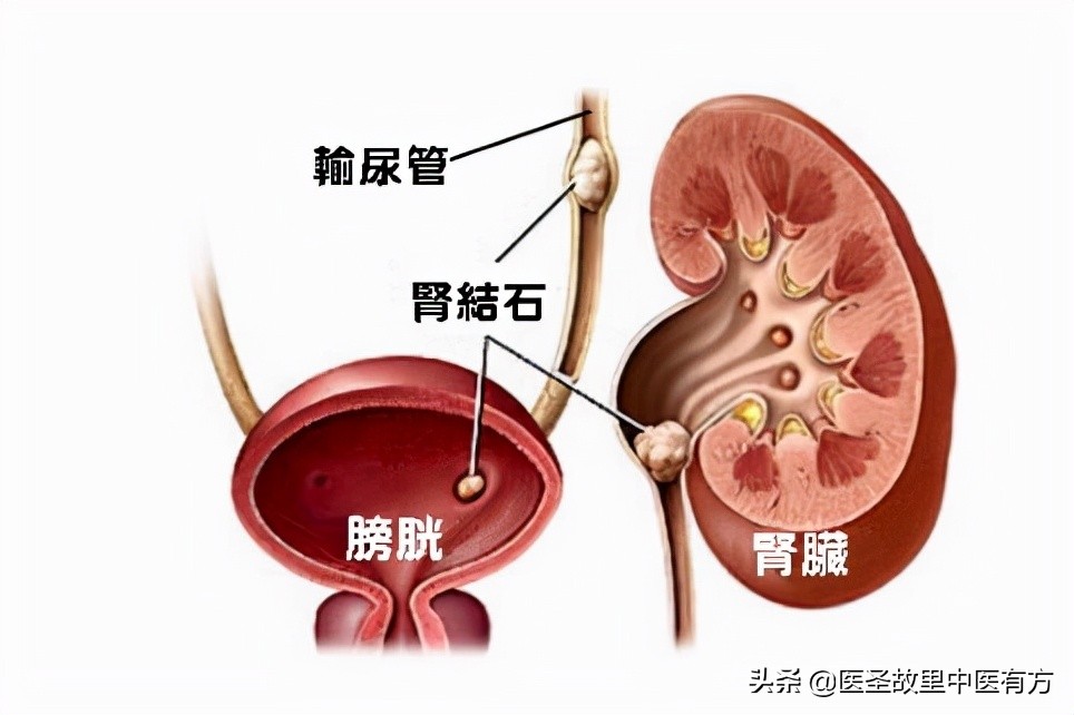 千古名方三仁汤，宣肺和胃，健脾利湿，可清三焦湿热、除一身杂症