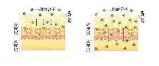 "果酸换肤"大揭秘，想要美白祛斑祛痘抗衰看这里