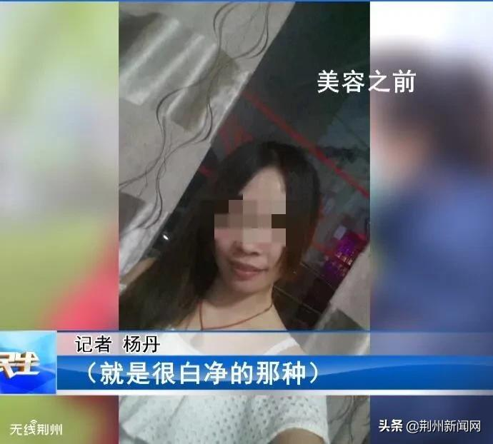 美容变毁容？荆州一女子使用美容产品后，莫名患上皮肤病......