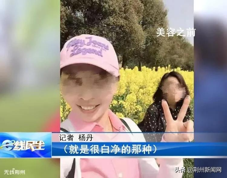 美容变毁容？荆州一女子使用美容产品后，莫名患上皮肤病......