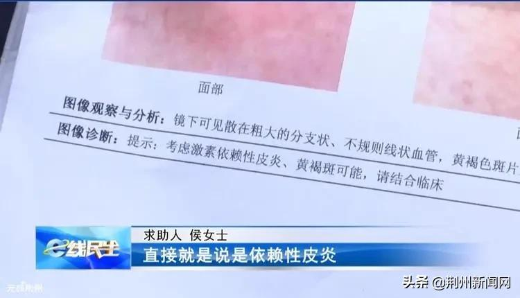 美容变毁容？荆州一女子使用美容产品后，莫名患上皮肤病......