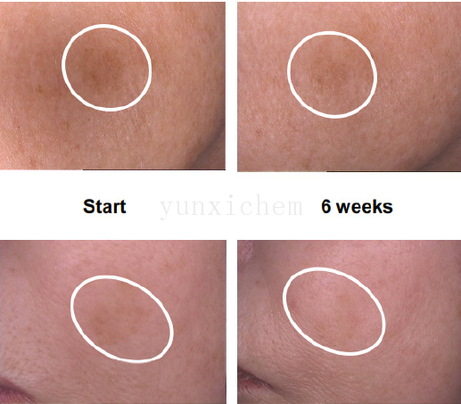 四肽-27 Ttrapeptide-27 四胜肽 美白淡斑均匀肤色