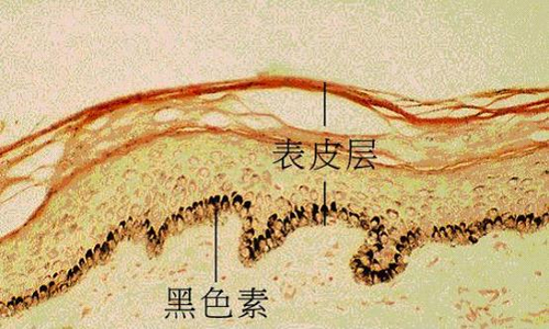 为什么你的色斑祛不掉？搞定它就OK