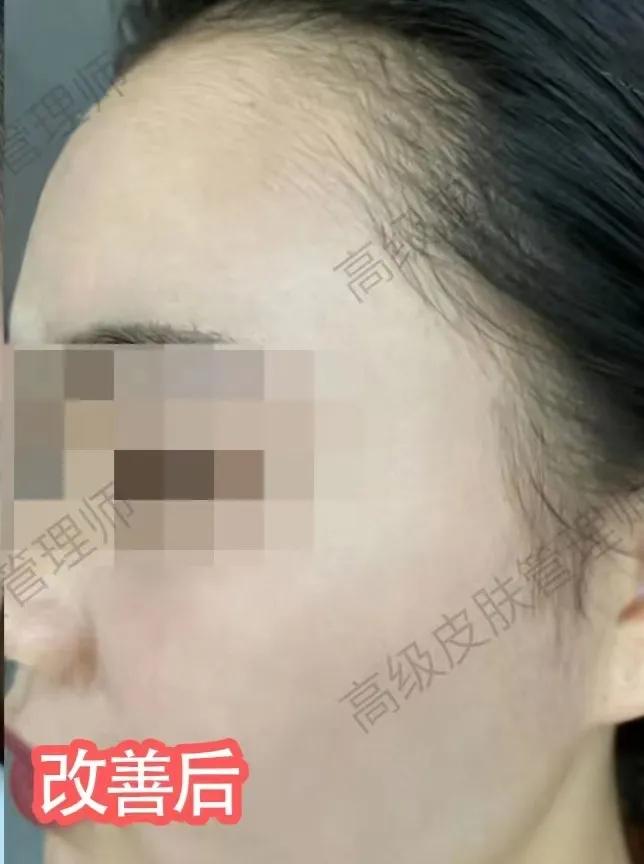 真实祛斑经历分享，所有女人的心声