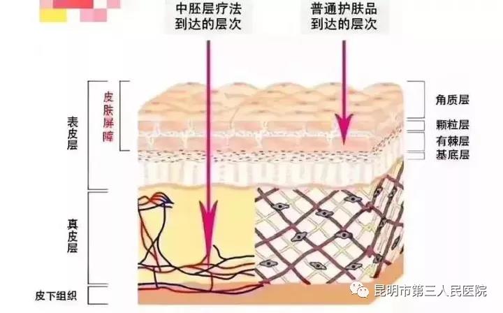 痘印的产品，昆明市三院皮肤科上线“纳晶微针”美容治疗项目