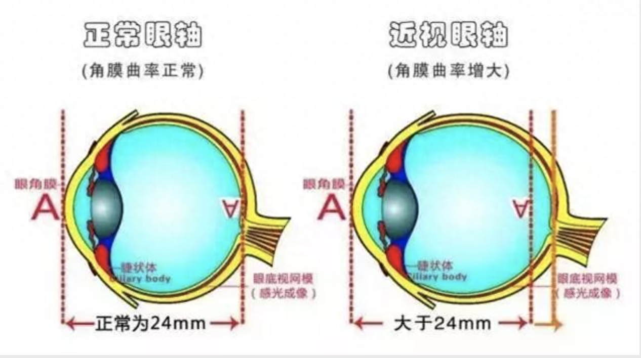 激光除疤4cm一般多少钱,激光祛斑去哪里做比较好，激光近视手术后会反弹？医生：那是因为你不知道这些